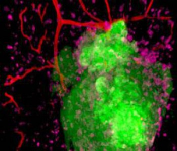 Could an image like this win? Professor Martin Knight's image shows the ovarian cancer cells of a mouse in green, immune cells in pink and blood vessels in red. 