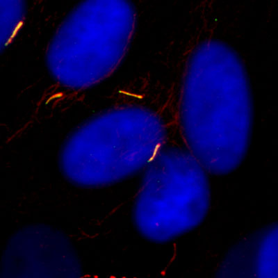 Confocal image showing primary cilia labelled in isolated tenocytes